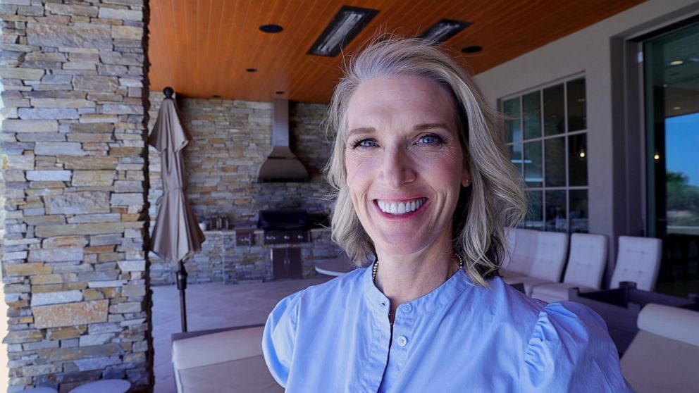 Foto: Allison O'Neill, din Arizona, după ce a suferit o intervenție chirurgicală și un tratament pentru o tumoare canceroasă pe față.