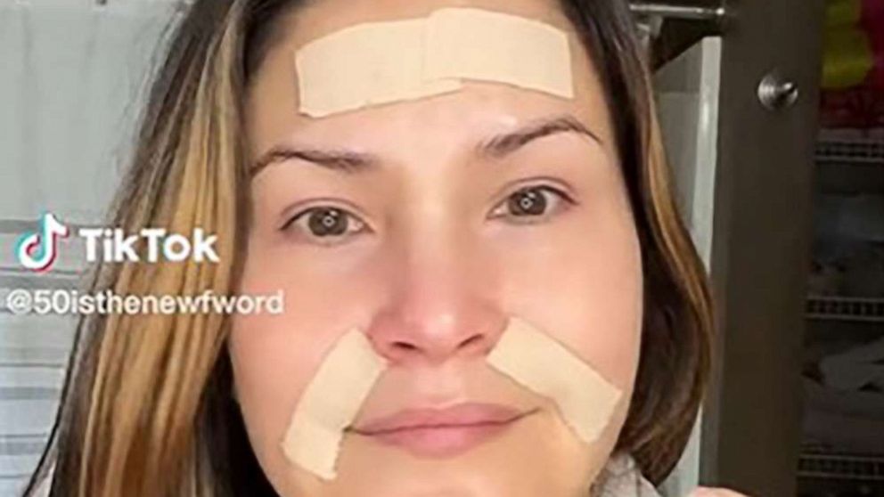 Does the TikTok trend of face taping to stop wrinkles work? A doctor weighs  in - Good Morning America