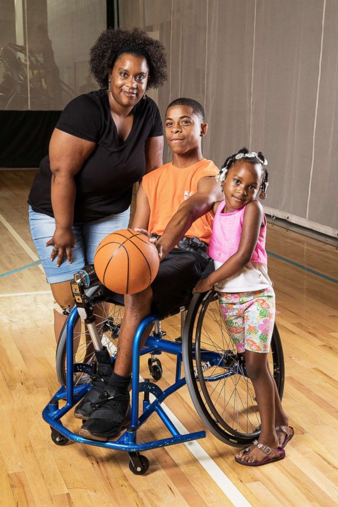 PHOTO: Fourteen-year old Kaileb and his mother (pictured) have a rare condition called congenital deficiency of the tibia that occurs once in every million live births. His sister is also pictured here. 