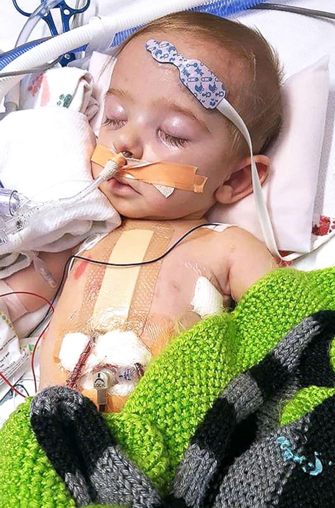 PHOTO: Gavin Bond has a congenital heart defect making being exposed to illness is detrimental to his health.