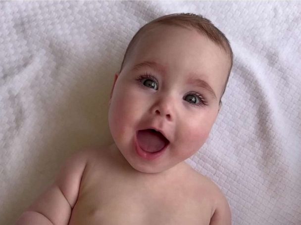 Cutest little baby faces: Meet TODAY's Babies of the Week