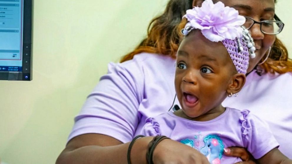 PHOTO: The moment deaf toddler A'deja Rivers, 1, hears for the first time after receiving cochlear implants was caught on video. 