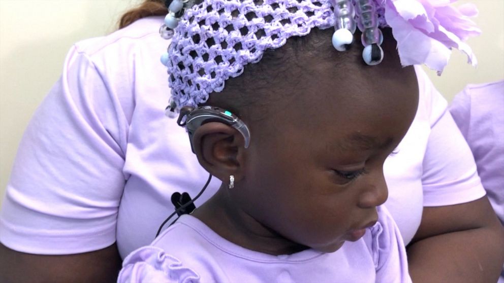 PHOTO: The moment deaf toddler A'deja Rivers, 1, hears for the first time after receiving cochlear implants was caught on video. 