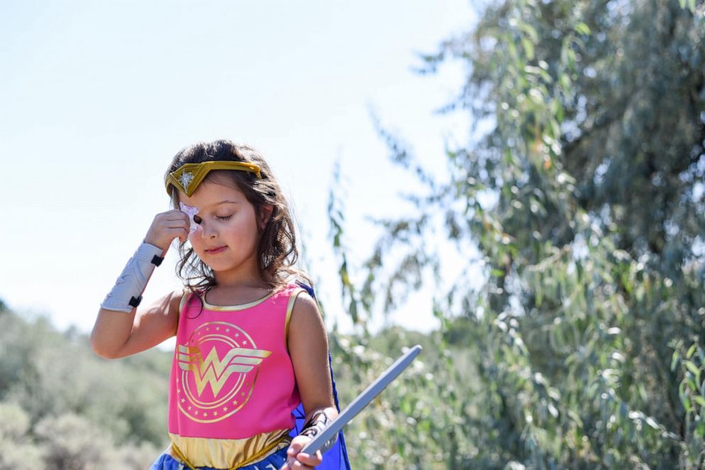 PHOTO: Aliyah Arambul's photo shoot celebrating her eye injury recovery was styled by her mom, Jessie Arambul, of Pasco, Washington.