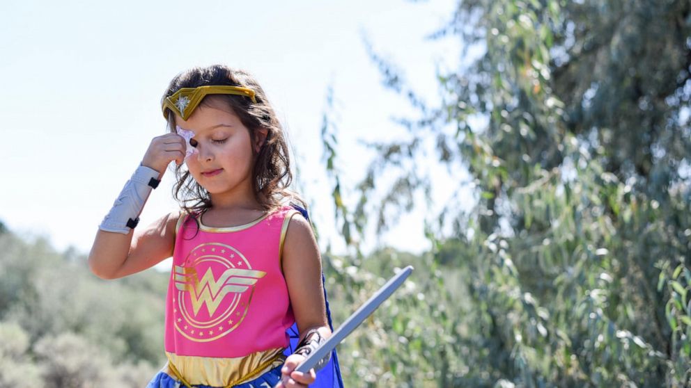 PHOTO: Aliyah Arambul's photo shoot celebrating her eye injury recovery was styled by her mom, Jessie Arambul, of Pasco, Washington.