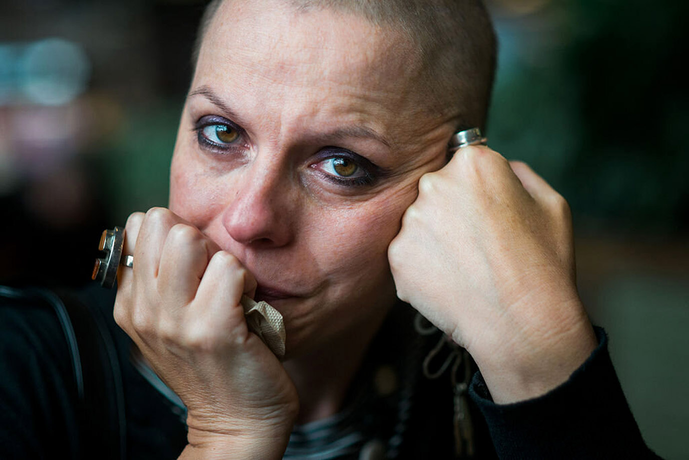 PHOTO: After Anna Rathkopf was diagnosed with an aggressive form of breast cancer at age 37, her husband, Jordan Rathkopf, who is a professional photographer, documented their journey in a series of powerful photos to show the realities of caregiving.