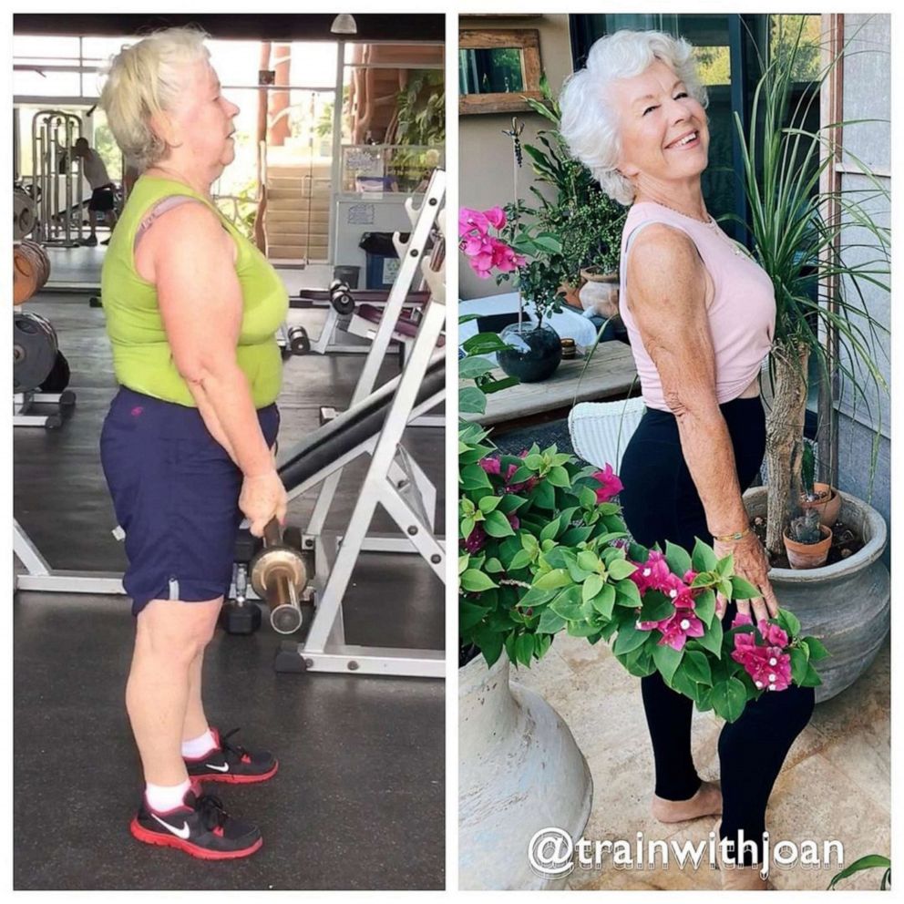 PHOTO: Joan MacDonald, who has lost over 60 pounds and become a health and wellness influencer on social media is pictured in an undated instagram side by side post.