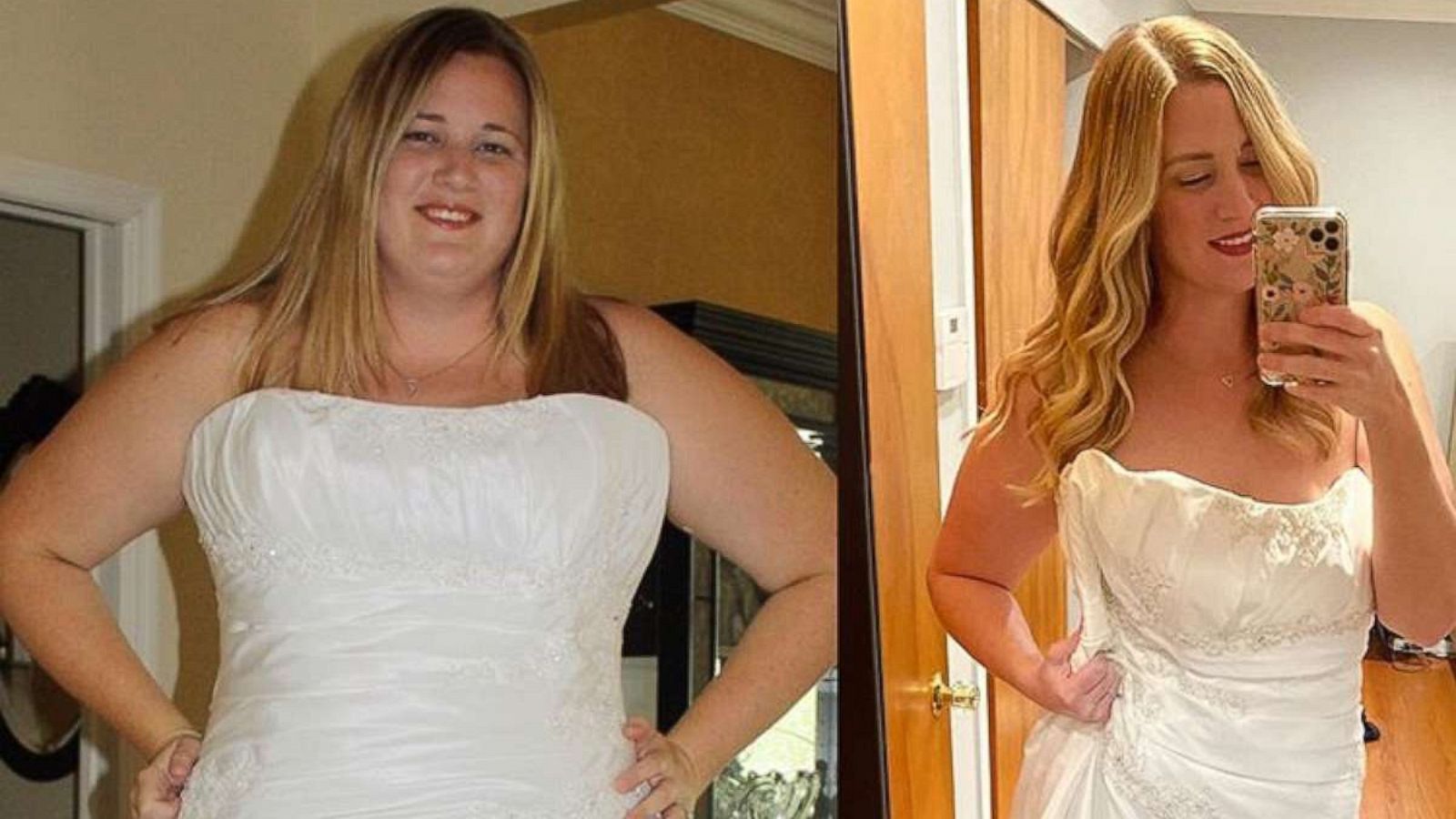 PHOTO: Suzanne Ryan lost more than 100 pounds following the keto diet.