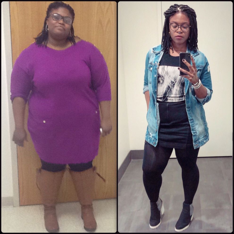 PHOTO: Liz Rock, 30, of Boston, has lost 150 pounds over the past five years.