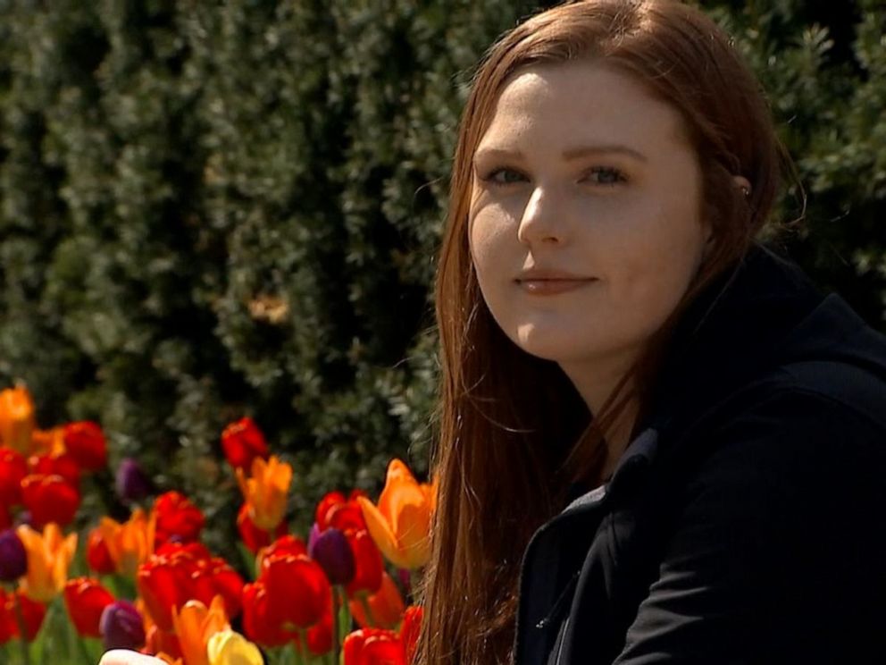 PHOTO: Megan Didio, 21, was diagnosed with skin cancer, despite having no family history of the disease.