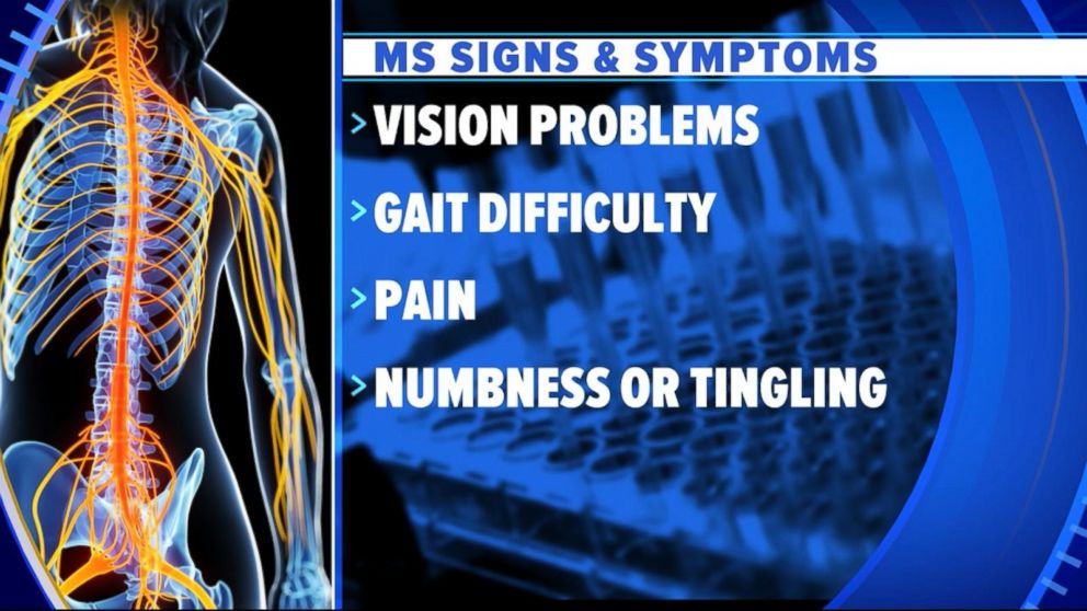 PHOTO: Signs and symptoms of MS.