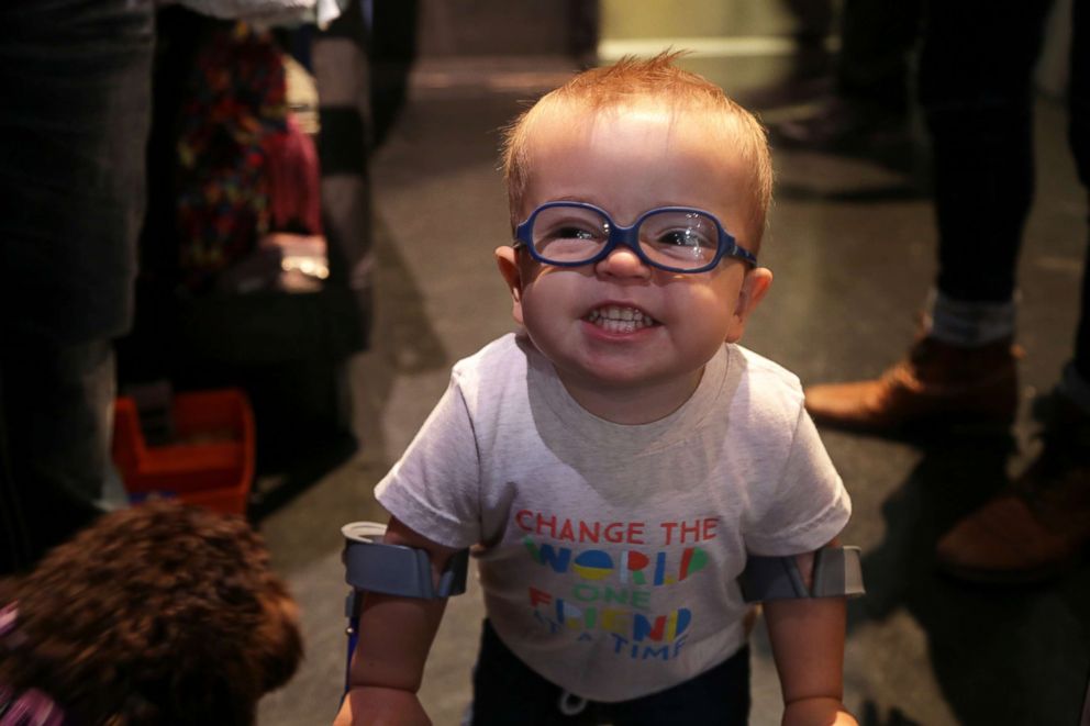 PHOTO: Roman Dinkel, 2, who has spina bifida, has persevered and started using a walker at 1 year old.