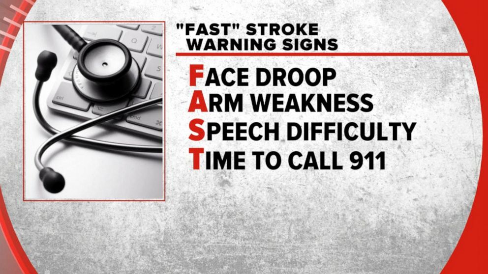 PHOTO: "FAST" stroke warning signs.