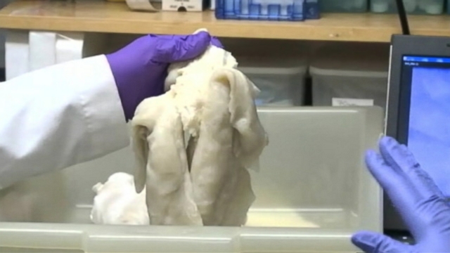 Human Lung Grown in Pet Shop Fish Tank Video - ABC News