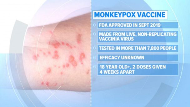 What's monkeypox?' Woman with 'insane rash' turned away for testing