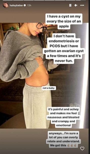 Hailey Bieber reveals she has ovarian cyst: What to know about the