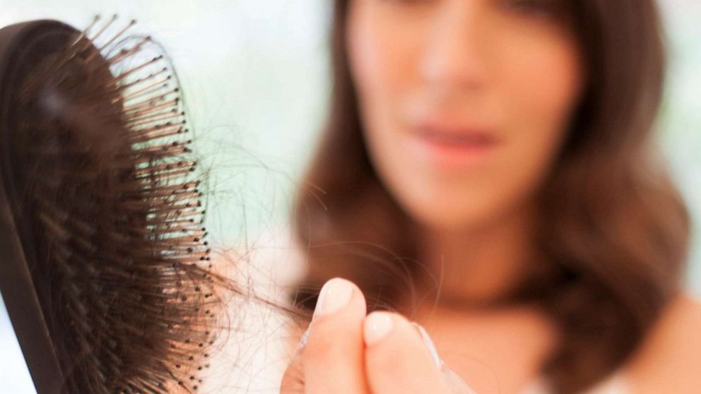 New study finds some natural hair loss supplements may actually work - Good  Morning America