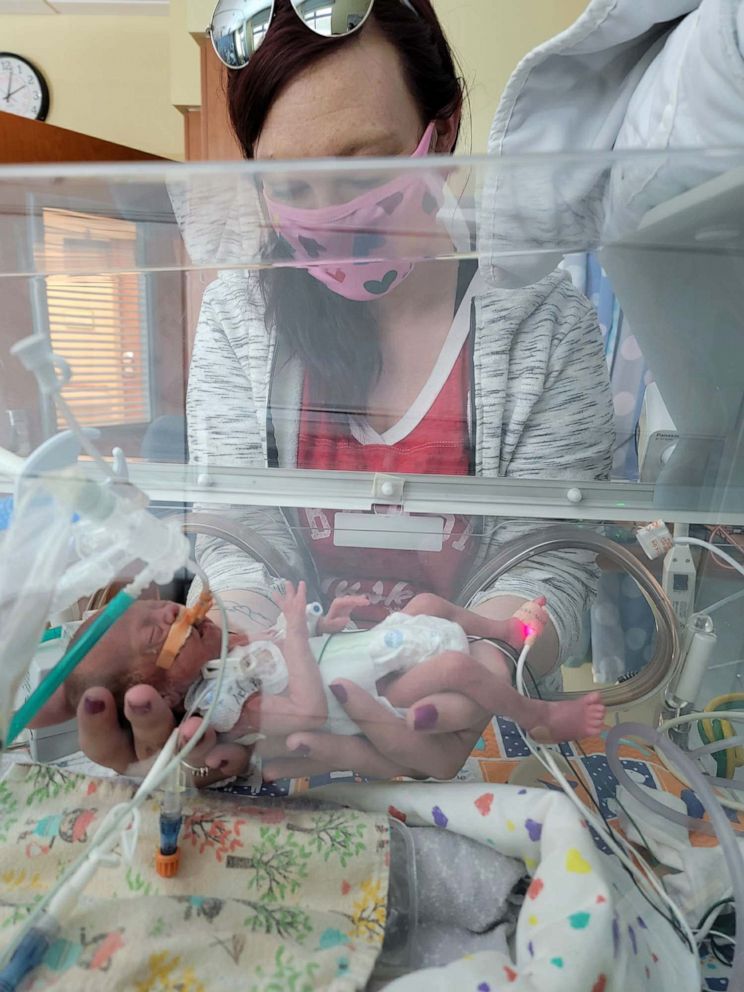 PHOTO: Harper was born at 23 weeks on Feb. 22, 2021 in Nebraska and later, had to be transferred for further treatment at Rocky Mountain Hospital for Children in Denver, Colorado.