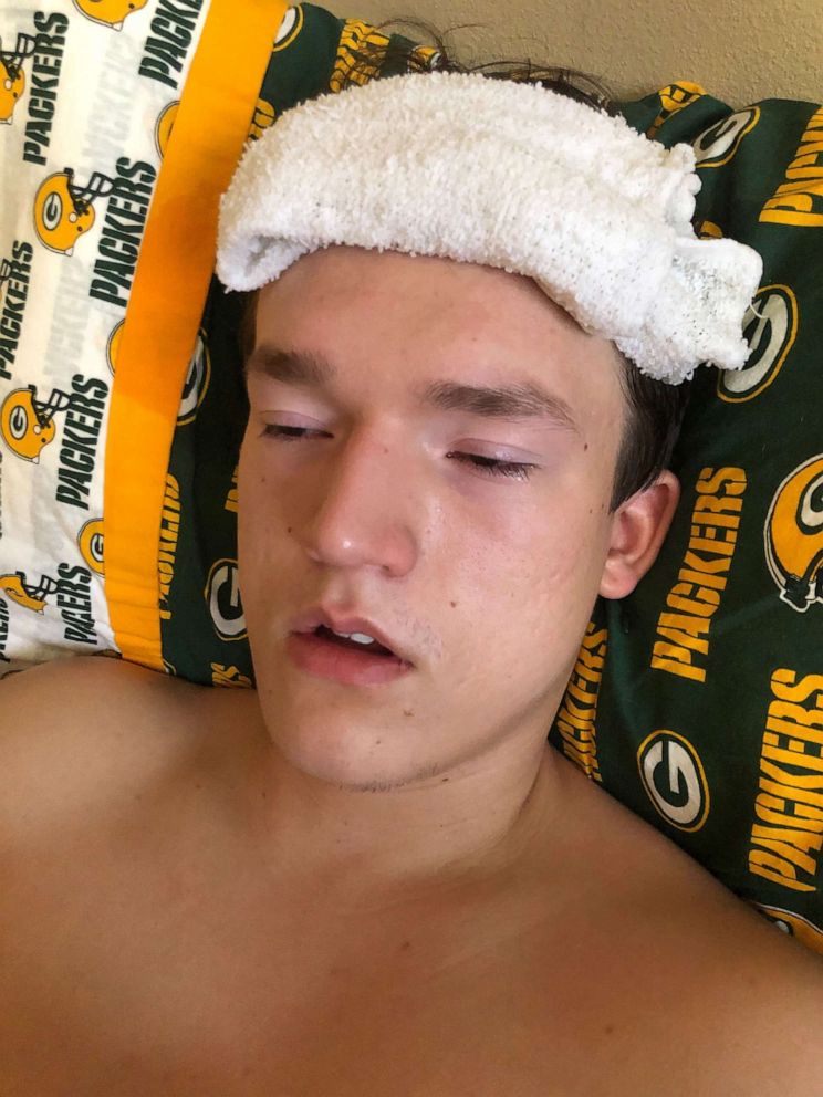 PHOTO: Dimitri Mitchell, 18, of Tiffin, Iowa, tested positive for the novel coronoavirus, COVID-19, March 17, 2020.