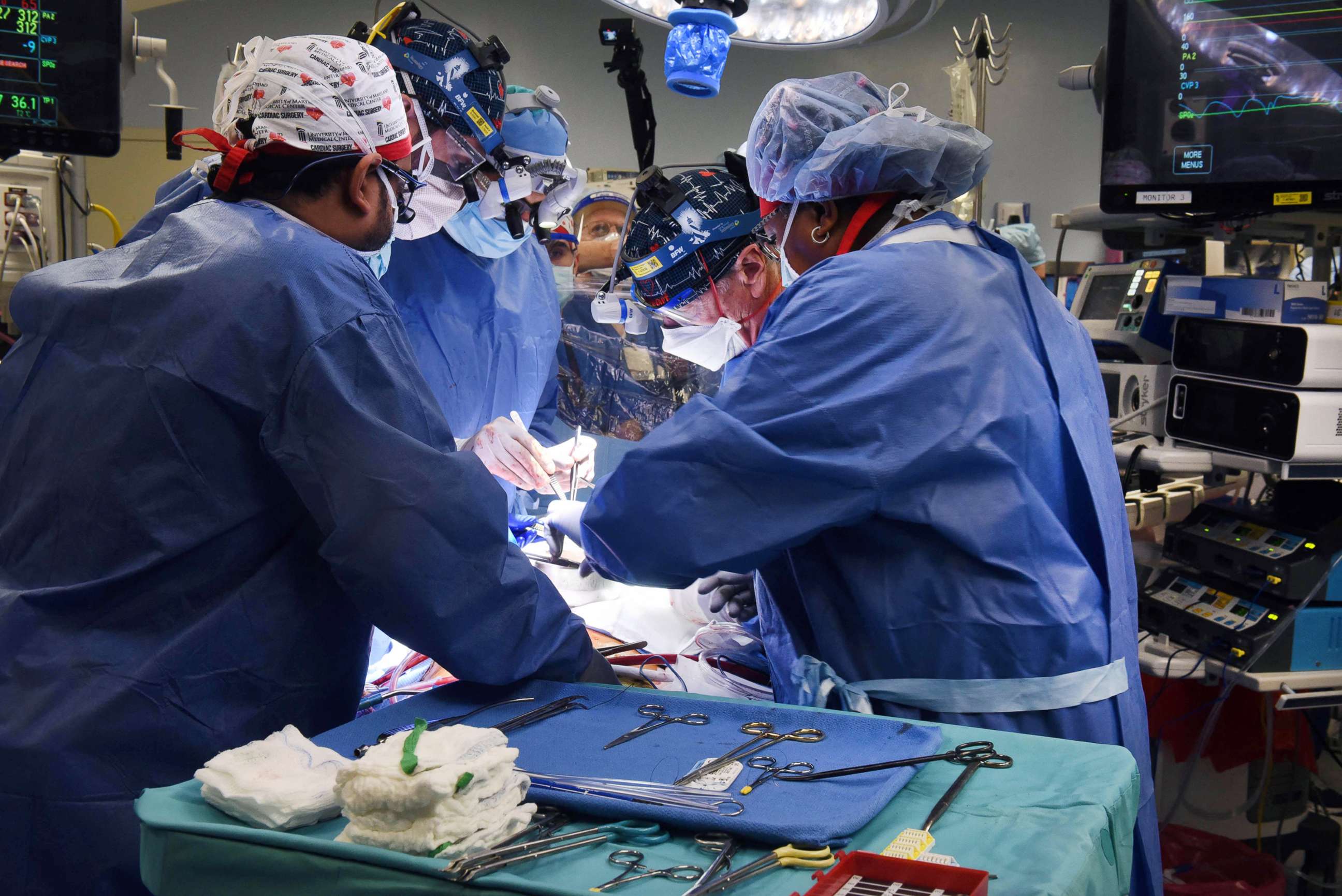 PHOTO: Surgeons perform a transplant of a heart from a genetically modified pig to patient David Bennett, Sr., in Baltimore, Jan, 7, 2022, in a first of its kind procedure.