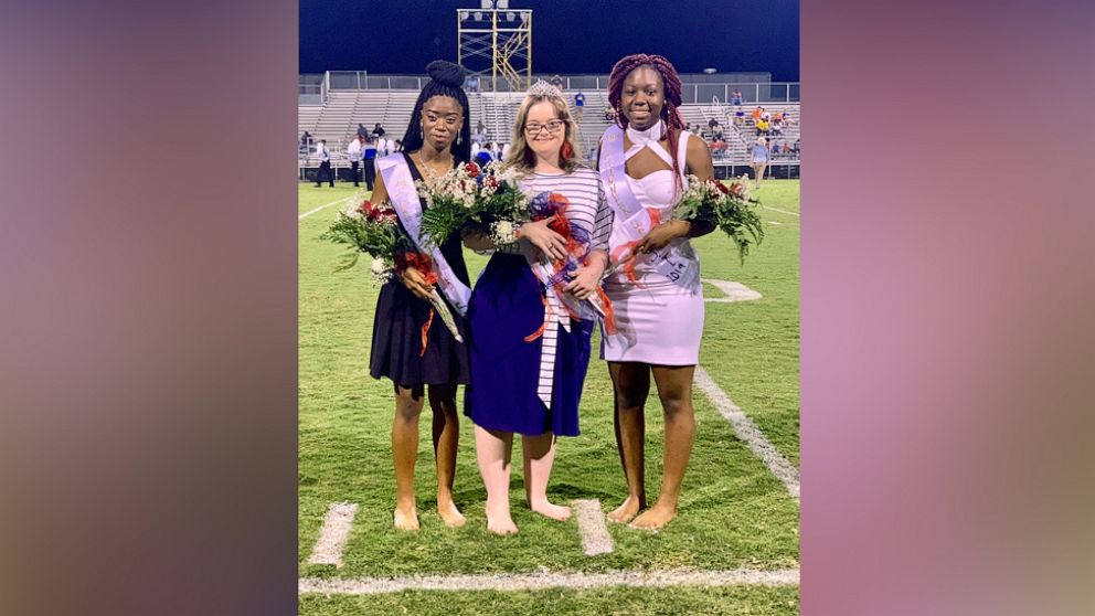 Nataleigh Deal, 19, who has epilepsy, had a seizure before the homecoming game at Strom Thurmond High School in Edgefield, South Carolina, on Oct. 4.