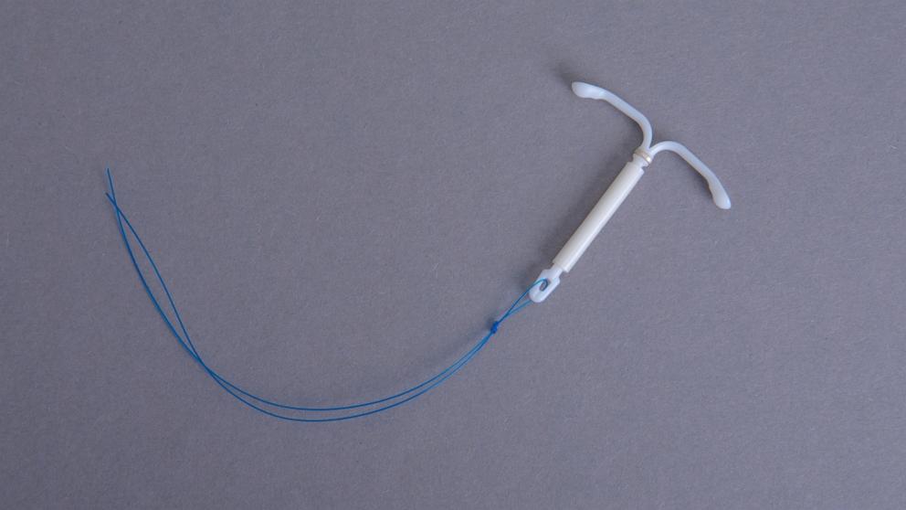 PHOTO: Hormonal IUD.