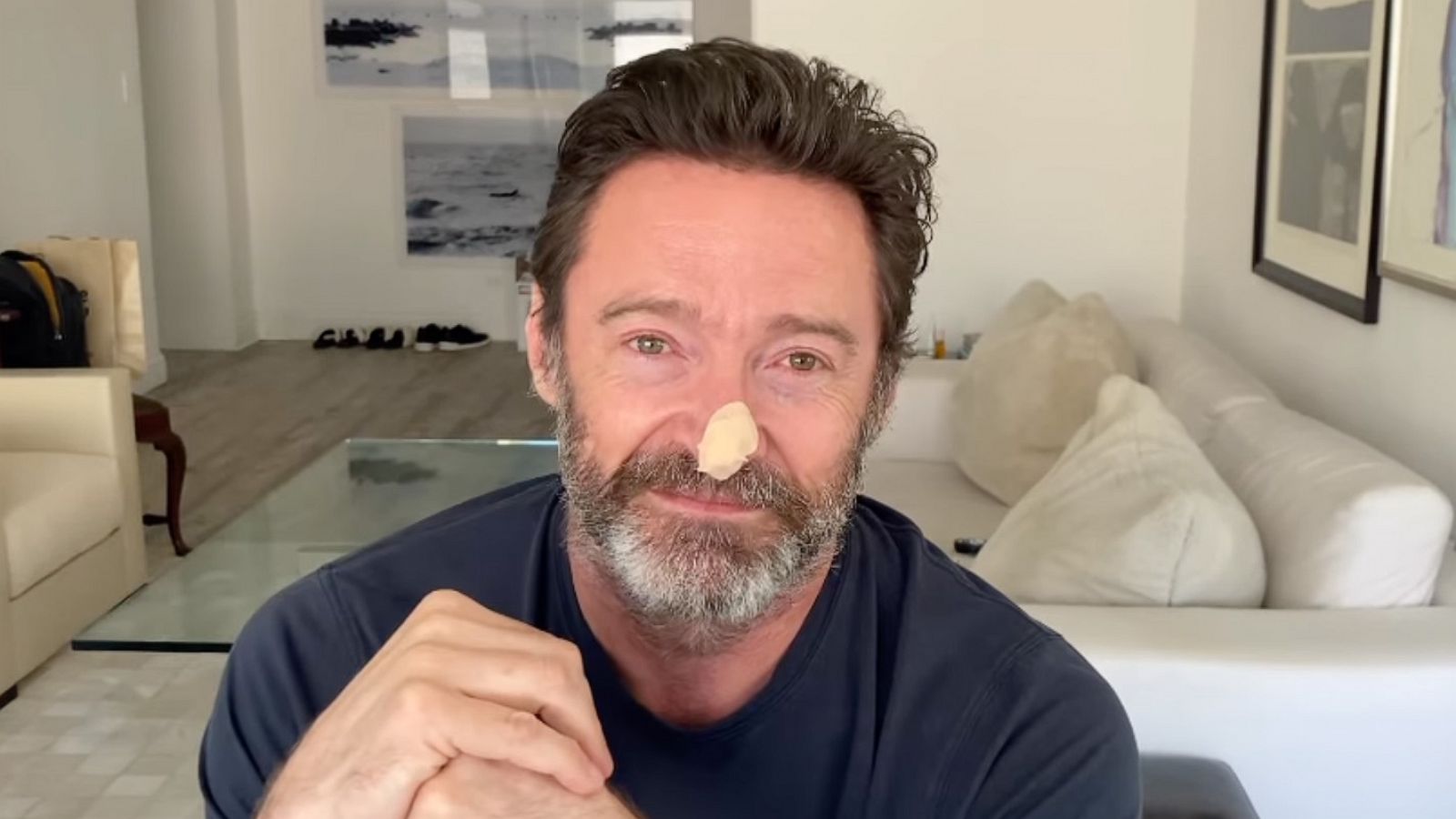 PHOTO: In a post made to his Instagram account, Hugh Jackman reveals his bandaged nose following two biopsies.