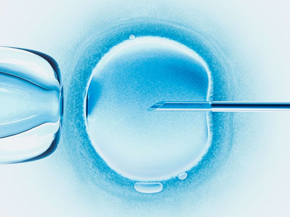 PHOTO: A photo illustration demonstrating in vitro fertilization.