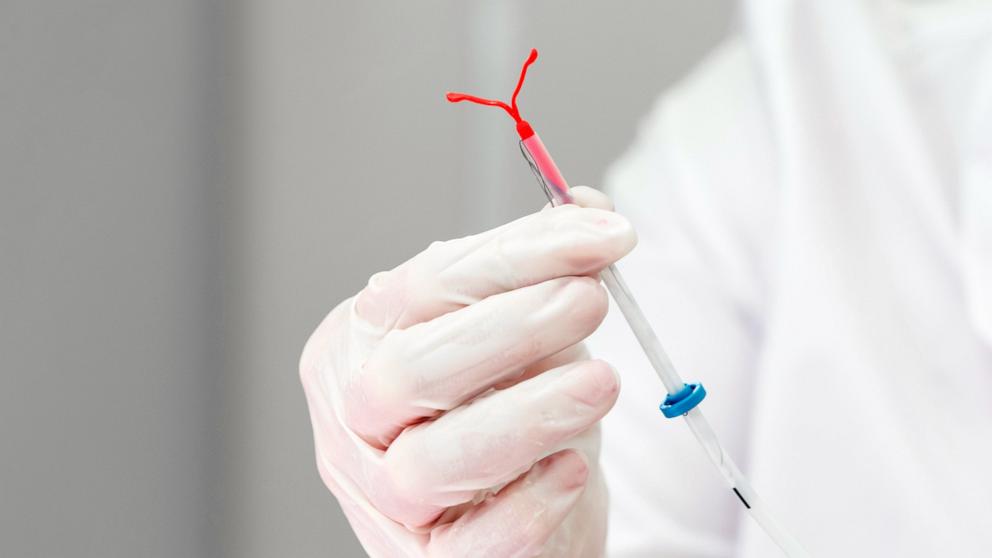 PHOTO: Stock photo of a doctor holding an IUD device.
