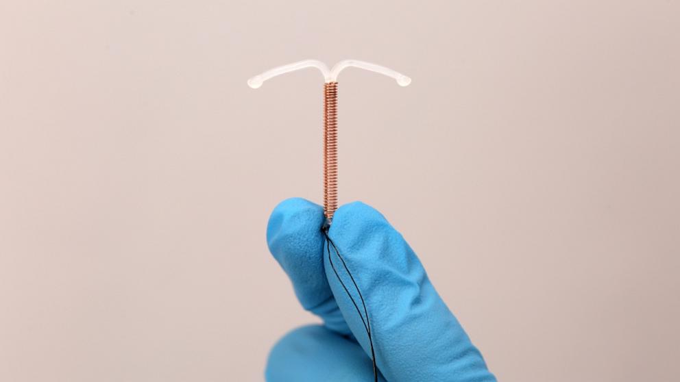 PHOTO: In this undated stock photo an IUD is held by a medical professional. 