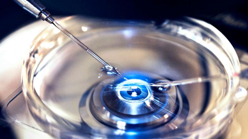 PHOTO: A close up of InVitro Fertilization in which donor sperm is injected into harvested egg cell to create embryo in an undated stock photo.