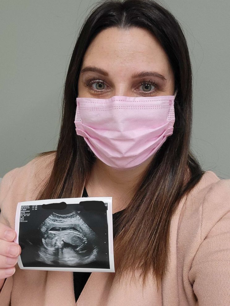 PHOTO: Following a successful embryo transfer, Lauren and EJ Wynn celebrate their 17th week of pregnancy