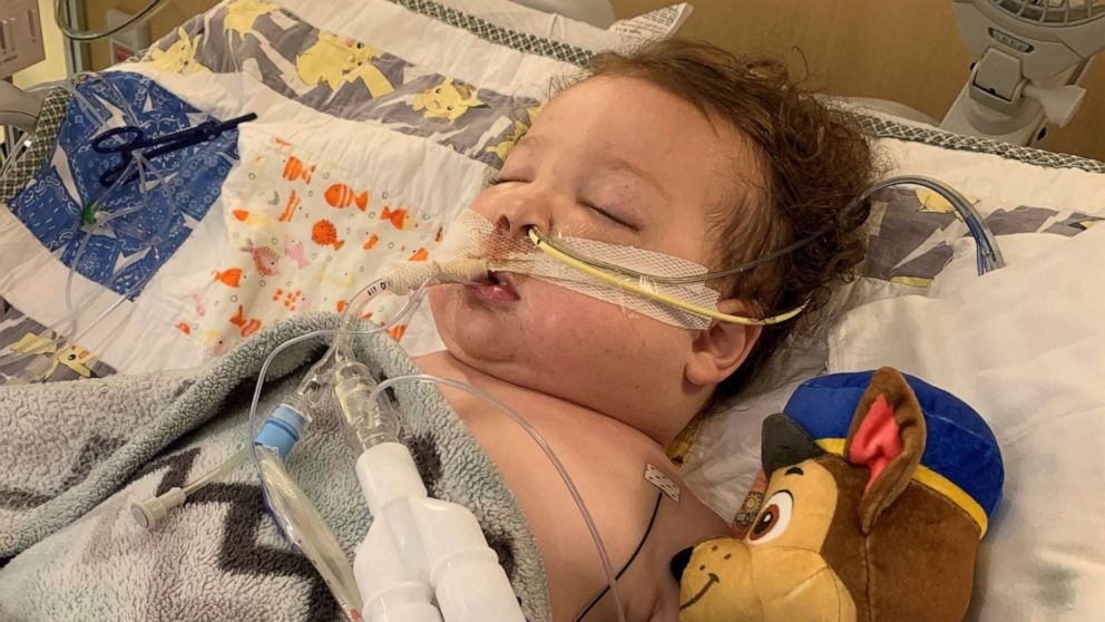 PHOTO: Adrian James, 2, of Mt. Vernon, Illinois, spent five days on a ventilator while battling COVID-19.