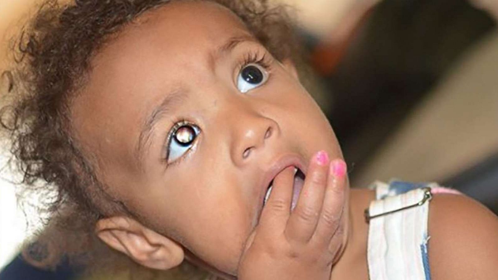 PHOTO: Jasmine Martin of Knoxville, Tenn., spotted a glow in her daughter Sariyah's eye.