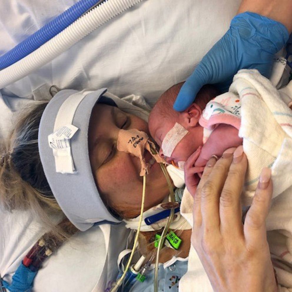 VIDEO: Mom delivers while sedated due to COVID, meets baby 1 month later