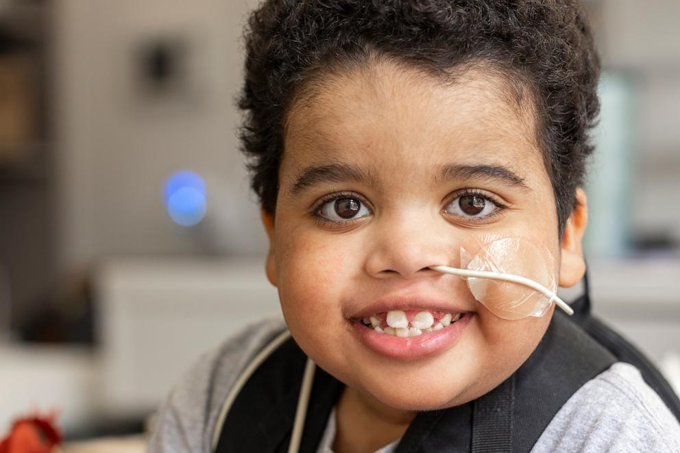 PHOTO: John-Henry was born with hypoplastic left heart syndrome or HLHS, a rare congenital condition that impacts blood flow through the heart.