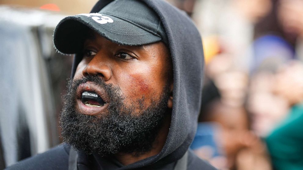 PHOTO: Kanye West aka Ye is seen wearing a Balenciaga boxing mouth guard, outside Givenchy, during Paris Fashion Week, Oct., 2, 2022 in Paris.