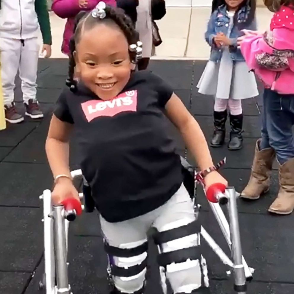 VIDEO: 4-year-old girl with spina bifida walks for first time as her friends cheer her on