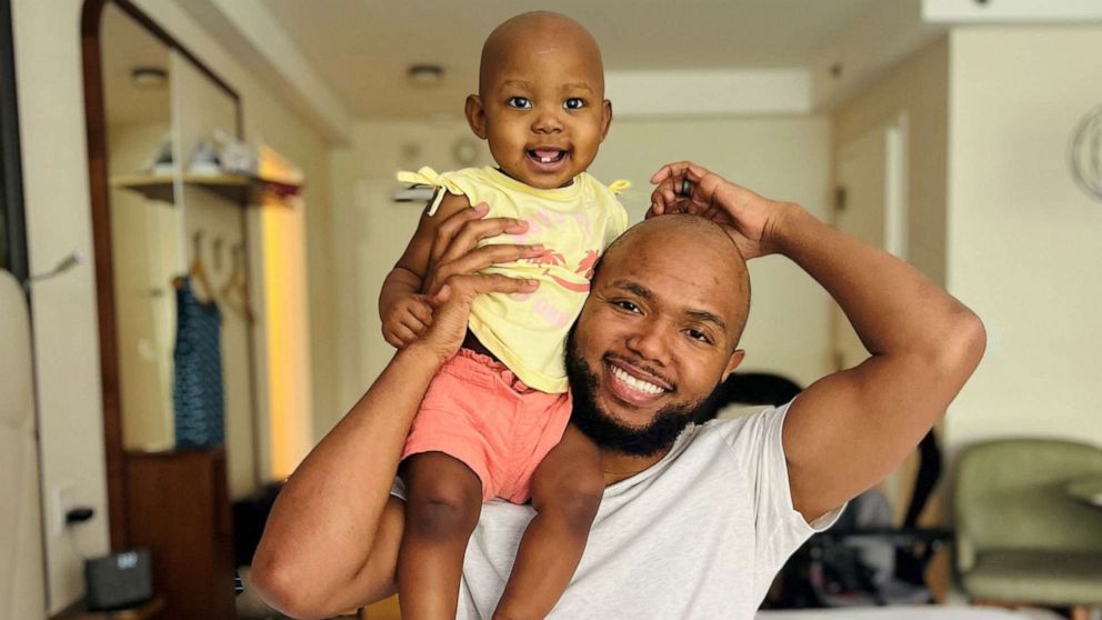 Dad shaves hair after 10 years to support daughter undergoing