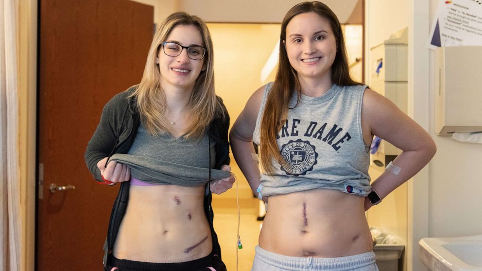 PHOTO: In this undated photo, Bethany and Hannah Goralski are shown prior to their kidney donation surgery. 