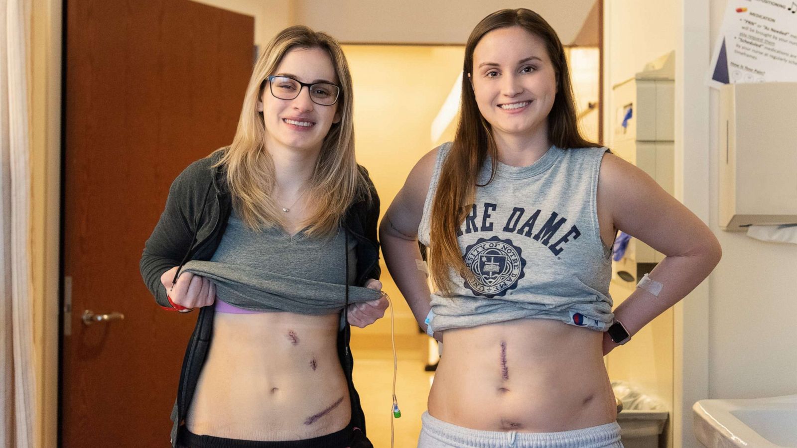 PHOTO: In this undated photo, Bethany and Hannah Goralski are shown prior to their kidney donation surgery.