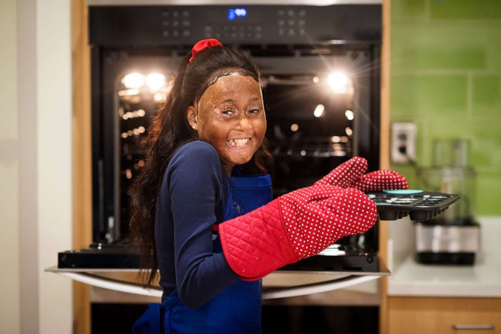 PHOTO: Ariana was born with sickle cell disease and wants to be a chef when she grows up.