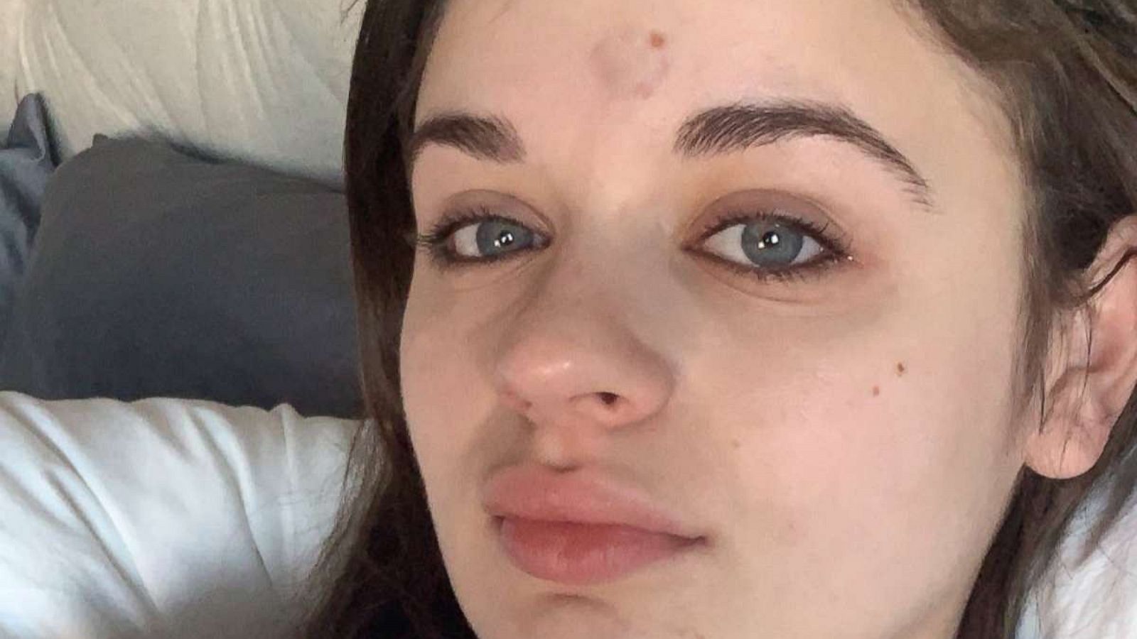 PHOTO: Joey King posted this photo to her Twitter account after she claimed Patricia Arquette accidentally hit her on the head with her Golden Globe, Jan. 6, 2020.