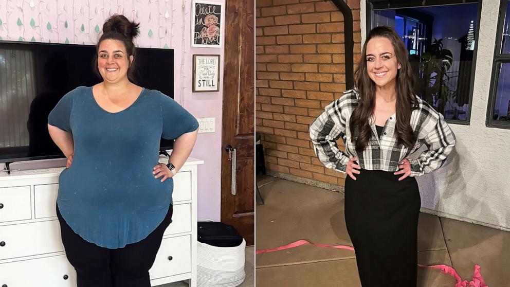 PHOTO: Leah Hope says she lost over 200 pounds over the course of two years.