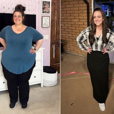 PHOTO: Leah Hope says she lost over 200 pounds over the course of two years.