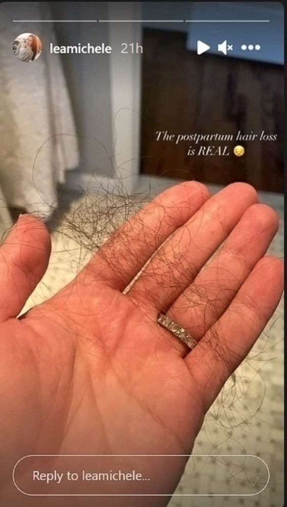 PHOTO: Lea Michele toont wat van haar haar in deze afbeelding die ze postte in een verhaal op haar Instagram-account waarin ze postpartum haaruitval bespreekt.