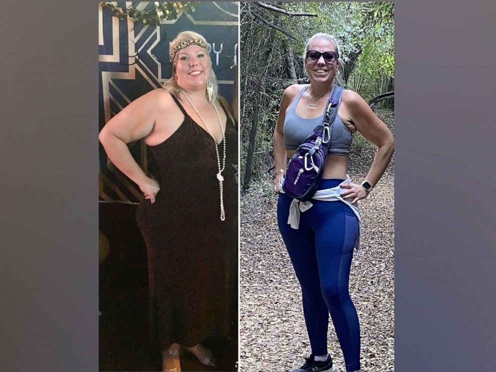 PHOTO: Penny Leaver, 43, of Farmersville, Texas, lost over 150 pounds over the course of three years.