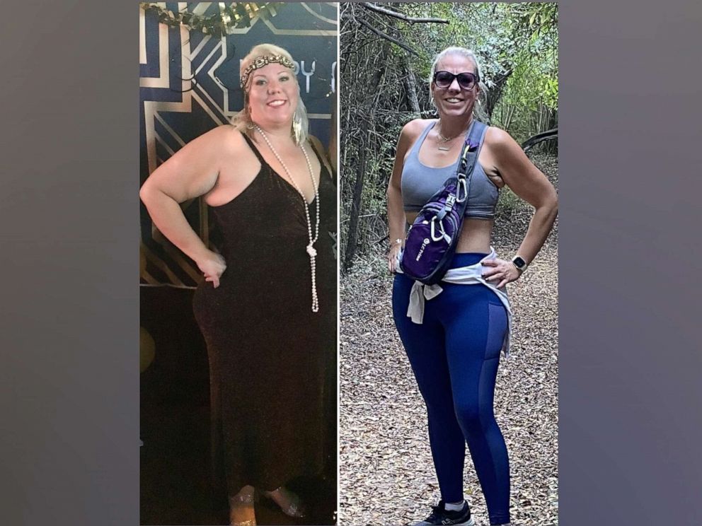 How one woman lost nearly 160 pounds in 1 year - Good Morning America