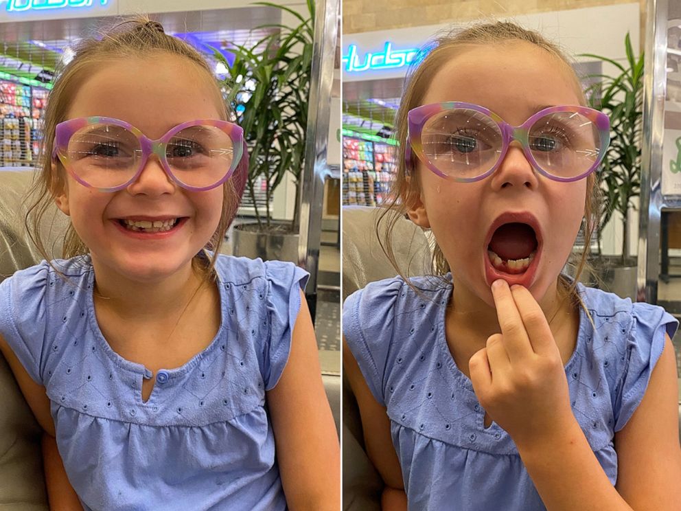 PHOTO: Lena said she has lost several teeth already, including on past trips to Tennessee and St. Croix, but this is her first time losing a tooth in the sky.
