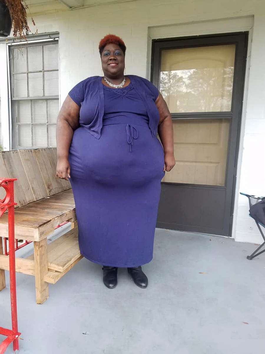 PHOTO: Leneathra Reed, 39, of Meridian, Mississippi, has kicked off her plan to lose 451 pounds.